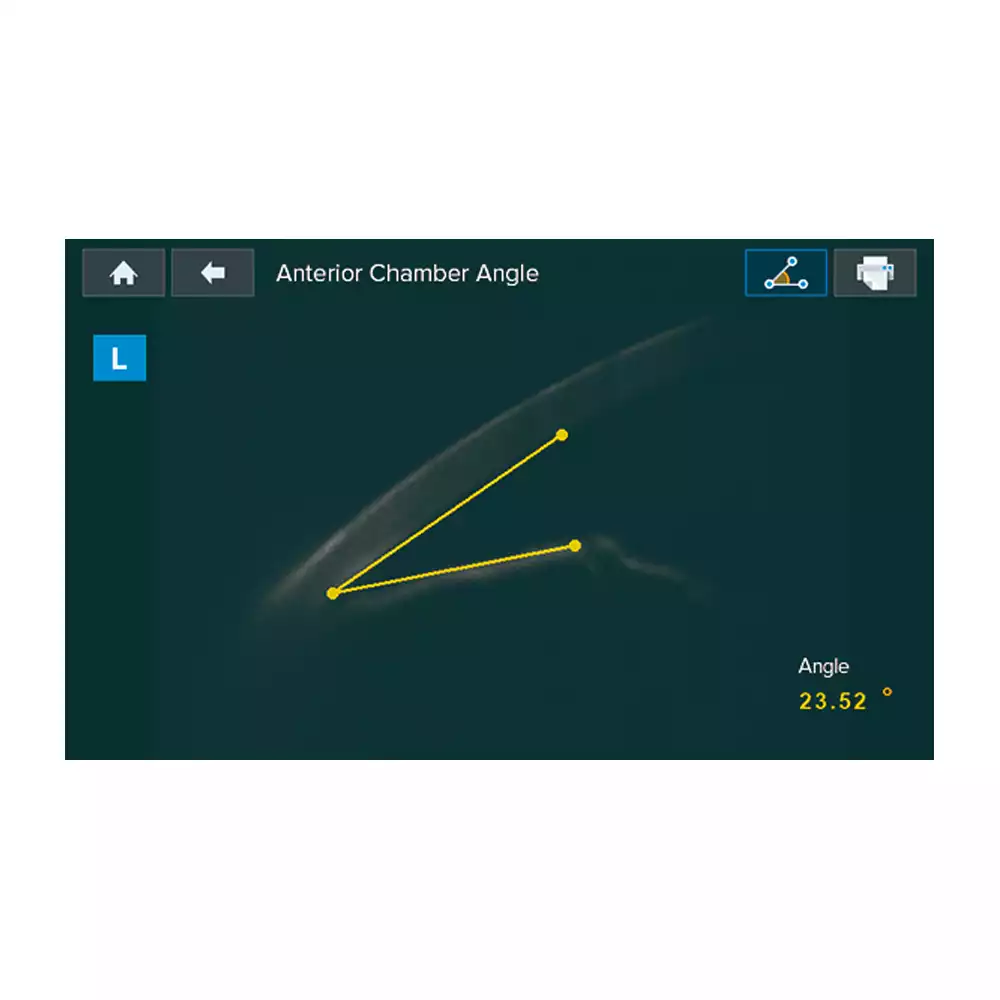 Тонометр HNT-1P внутриглазного давления, автоматический бесконтактный, с функцией измерения толщины роговицы