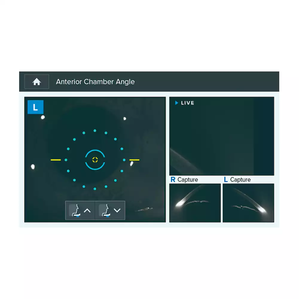 Тонометр HNT-1P внутриглазного давления, автоматический бесконтактный, с функцией измерения толщины роговицы
